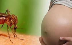 Bệnh đầu nhỏ do Zika chỉ phát hiện vào cuối thai kỳ