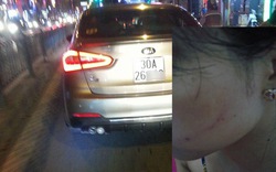 Cô gái tố tài xế ô tô tát sưng mặt vì “không nhường đường”