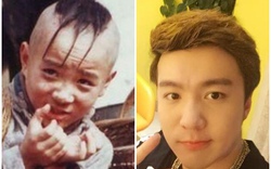 29 tuổi, cuối cùng "cậu bé Tam Mao" đã mọc tóc