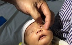 Nguy cơ khi nhỏ sữa mẹ vào mắt trẻ sơ sinh