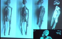 Tiết lộ mới về xác ướp "người ngoài hành tinh" ở Peru