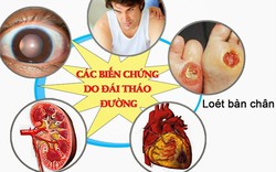 Bác sĩ BV Bạch Mai chỉ ra những sai lầm người đái tháo đường hay mắc phải