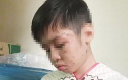 Bé trai bị đánh rạn xương sườn: Mẹ kế khai lý do hành hạ con chồng