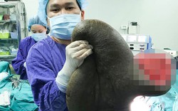 Người đàn ông “cõng” chiếc "mai rùa" nặng 15kg suốt hơn 20 năm