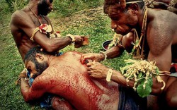 Bộ lạc nguyên thủy “xẻ thịt” bản thân để làn da giống như cá sấu