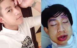 Số phận nghiệt ngã của hot boy rời nhóm HKT đình đám một thời