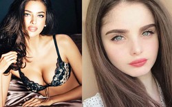 Đôi môi "thái vội được 2 đĩa" của Irina Shayk là chuẩn mới của gái đẹp Nga