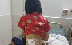 Công an Phú Yên trần tình vụ một phụ nữ bị trúng đạn cao su từ CSGT