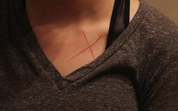Thanh niên suýt đi tù 99 năm vì bị tố khắc chữ X lên ngực bồ cũ