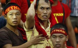 CĐV Việt Nam nên làm gì để tránh bị Ultras Malaysia hành hung ở Bukit Jalil?