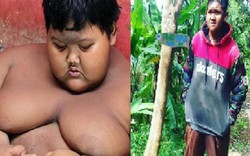 Sự biến đổi kinh ngạc của cậu bé béo nhất thế giới
