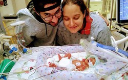 Mỹ: Cậu bé “không có ruột” sống sót kỳ diệu sau khi sinh ra