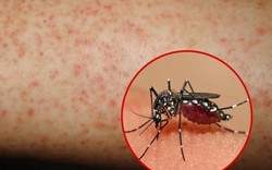 Một bé trai 12 tuổi tử vong do sốt xuất huyết DenGue