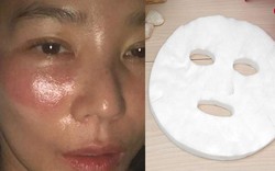 Hoa hậu Hoàn Quốc gặp họa vì sai lầm ngủ quên khi đắp mặt nạ