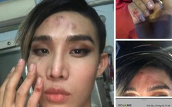 GoViet lên tiếng vụ người mẫu MiD Nguyễn tố bị tài xế hành hung