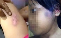 VIDEO: Bé gái 6 tuổi ở TP.HCM kể việc bị bạo hành