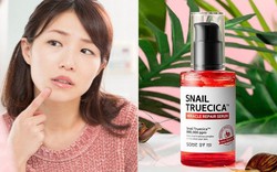 Top 6 sản phẩm trị mụn hiệu quả được phụ nữ Hàn yêu thích