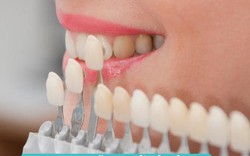 Bọc răng sứ là gì? Những tác hại và biến chứng nguy hiểm khi bọc răng sứ