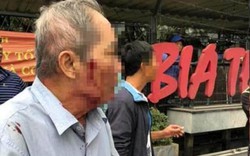 Cụ ông bị lái xe ôm hành hung: "Tôi chỉ hóng gió mà đánh tôi dã man quá"