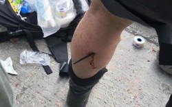 Hong Kong: Cảnh sát bị tên bắn vào chân trong cuộc đụng độ với người biểu tình