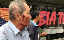 Hà Nội: Điều tra vụ cụ ông 80 tuổi chạy xe ôm bị đánh đến nhập viện