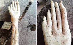 "Nổi da gà" phát hiện củ khoai kỳ lạ có hình bàn tay người