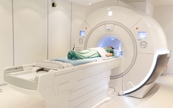 Đột quỵ não và vai trò của chụp cộng hưởng từ (MRI) trong tầm soát đột quỵ