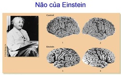 Bộ não của các thiên tài hoạt động như thế nào?
