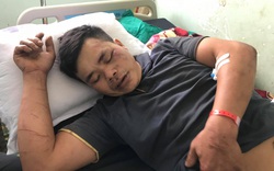 17 nạn nhân trong vụ lật xe khách tại Kon Tum đã được xuất viện