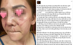 Sau giảng viên Âu Hà My, đến lượt hot girl Hà thành gây "bão" mạng, tố chồng bạo hành?