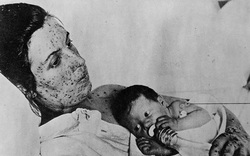 Clip: Những đại dịch kinh hoàng nhất trong lịch sử nhân loại trước đại dịch Covid-19