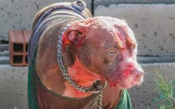 Bị 7 con chó Pitbull tấn công, người đàn ông xấu số bị cào nát mặt 