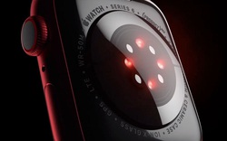 Cú sốc đồng hồ Apple Watch sẽ bị cấm bán vì điều này