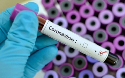 Biến thể SARS-CoV2 ở Pháp có thể "né" được xét nghiệm PCR