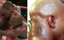 Mike Tyson cắn đứt tai Evander Holyfield: Điều gì xảy ra với mảnh tai?