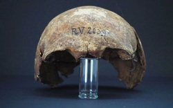 Phát hiện hộp sọ 5.000 năm tuổi của người đầu tiên từng nhiễm bệnh dịch hạch 