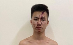 Thái Nguyên: Mâu thuẫn lúc chơi bida, thanh niên 18 tuổi đâm 1 người tử vong 