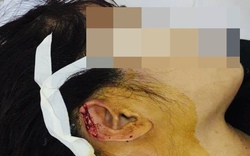 Thanh Hóa: Lời khai của người phụ nữ đánh ghen, đạp vỡ kính ô tô, cắn đứt tai cô gái