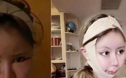 Người mẹ Nhật Bản ép con gái 9 tuổi cắt mí, làm mũi, nâng ngực