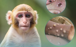 Bộ NNPTNT yêu cầu giám sát chặt động vật nhập cảnh từ quốc gia, vùng lãnh thổ có dịch đậu mùa khỉ