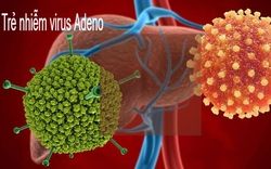 Trẻ nhiễm virus Adeno có triệu chứng thế nào? Khi nào cần phải đi viện? 