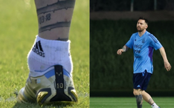 Hình ảnh mắt cá chân Messi sưng to: Liệu có đá trận gặp Saudi Arabia? 