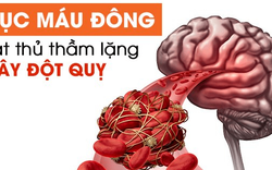 4 loại gia vị hỗ trợ giảm nguy cơ hình thành cục máu đông