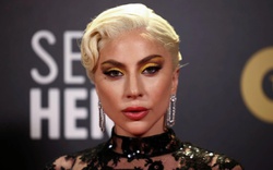 Cái kết đắng cho kẻ bắn người dắt chó đi dạo của Lady Gaga