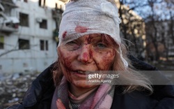 Những hình ảnh tang thương và loạn lạc tại Ukraine sau cuộc không kích