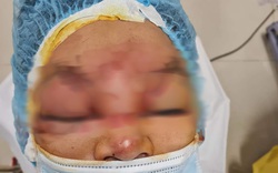 Đắk Lắk: Xem mẹ bơm lốp xe bị nổ, con trai hỏng mắt