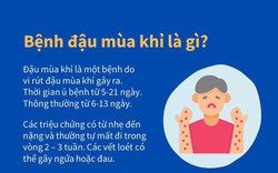 23 nước có người mắc bệnh đậu mùa khỉ, phòng ngừa bệnh đậu mùa khỉ thế nào? 