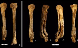 Bộ xương cổ đại tiết lộ hình phạt chặt chân phụ nữ Trung Quốc 3.000 năm trước