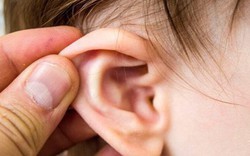 Bài thuốc đông y điều trị viêm tai giữa