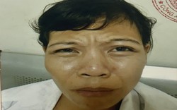 Cảnh sát truy tìm bị hại vụ trình báo bị đánh gãy mũi ở Hà Nội